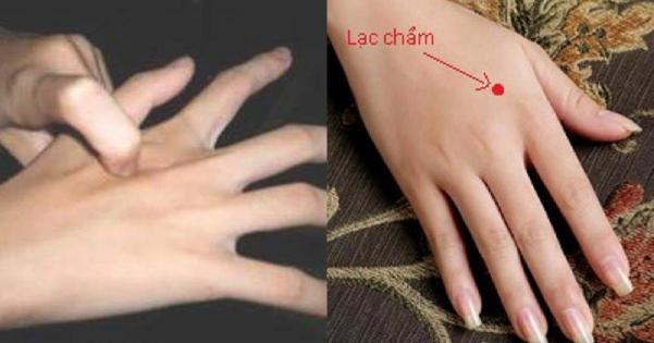 Huyệt lạc chẩm điều trị hiệu quả đối với chứng vẹo cổ